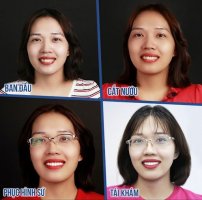 Chuyên gia điều trị những ca làm răng sứ hỏng – Cứu lấy nụ cười và niềm tin